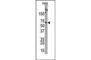 Image no. 1 for anti-Promyelocytic Leukemia (PML) (Sumoylation Site) antibody (ABIN357734) (PML antibody  (Sumoylation Site))