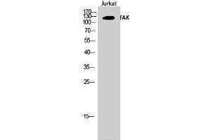Western Blotting (WB) image for anti-PTK2 Protein tyrosine Kinase 2 (PTK2) (Thr446) antibody (ABIN3184583) (FAK antibody  (Thr446))