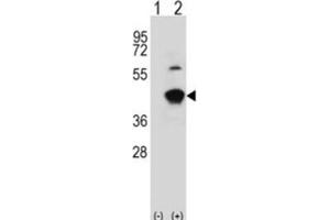 Western Blotting (WB) image for anti-Glycine C-Acetyltransferase (GCAT) antibody (ABIN3003250)