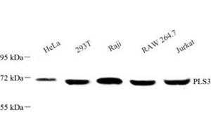 Western blot analysis of PLS3 (ABIN7075097) at dilution of 1: 500