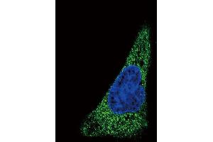 Confocal immunofluorescent analysis of SLC11A2 Antibody (Center) (ABIN657723 and ABIN2846709) with HepG2 cell followed by Alexa Fluor 488-conjugated goat anti-rabbit lgG (green). (SLC11A2 antibody  (AA 262-291))