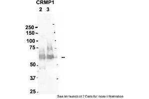 Sample Type: 2. (CRMP1 antibody  (N-Term))