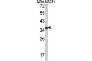 Western blot analysis of MSRB2 Antibody (Center) in MDA-MB231 cell line lysates (35ug/lane). (MSRB2 antibody  (Middle Region))