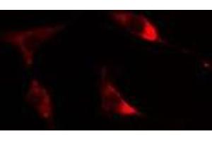 ABIN6275600 staining Hela cells by IF/ICC. (Sorting Nexin 1 antibody  (Internal Region))