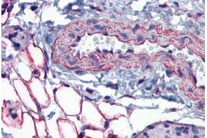 Mouse Vessel and Adipocytes: Formalin-Fixed, Paraffin-Embedded (FFPE) (PTRF antibody  (AA 177-226))
