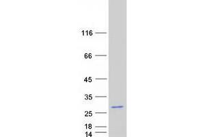 Western Blotting (WB) image for Transcription Elongation Factor B (SIII), Polypeptide 2 (18kDa, Elongin B) (TCEB2) (Transcript Variant 2) protein (Myc-DYKDDDDK Tag) (ABIN2733351)
