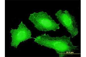 Immunofluorescence of monoclonal antibody to CTNNB1 on HeLa cell. (CTNNB1 antibody  (AA 682-781))
