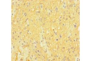 Immunohistochemistry (IHC) image for anti-Catenin (Cadherin-Associated Protein), delta 2 (Neural Plakophilin-Related Arm-Repeat Protein (CTNND2) (AA 4-308) antibody (ABIN7146992)