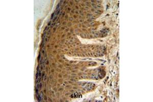 Immunohistochemistry (Paraffin-embedded Sections) (IHC (p)) image for anti-Elongation Factor Tu GTP Binding Domain Containing 2 (EFTUD2) (AA 263-293), (Middle Region) antibody (ABIN955417)