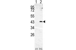 Western Blotting (WB) image for anti-Signal Peptide Peptidase 3 (SPPL3) antibody (ABIN3002611) (SPPL3 antibody)