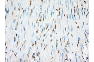 Immunohistochemical staining of paraffin-embedded colon tissue using anti-NME4 mouse monoclonal antibody. (NME4 antibody)