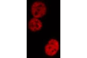 ABIN6274181 staining HeLa cells by IF/ICC. (UBTF antibody  (Internal Region))