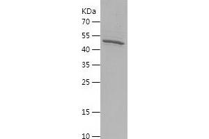 Western Blotting (WB) image for Phospholipase C zeta 1 (PLCz1) (AA 322-572) protein (His-IF2DI Tag) (ABIN7124433) (PLCz1 Protein (AA 322-572) (His-IF2DI Tag))