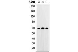 Western blot analysis of Beta-glucosidase 2 expression in A431 (A), HeLa (B), A549 (C) whole cell lysates. (GBA2 antibody  (Center))