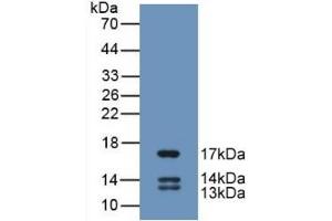 Detection of Recombinant UCN2, Human using Monoclonal Antibody to Urocortin 2 (UCN2) (Urocortin 2 antibody  (AA 20-112))