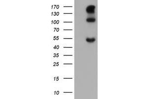 Image no. 1 for anti-Carbonic Anhydrase 12 (CA12) antibody (ABIN1497066) (CA12 antibody)