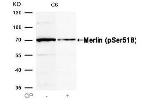 Western blot analysis of extracts from C6 cells, treated with calf intestinal phosphatase (CIP), using Merlin (Phospho-Ser518) Antibody. (Merlin antibody  (pSer518))