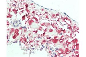Anti-Osteoglycin / Mimecan antibody IHC staining of human lung, pleura.