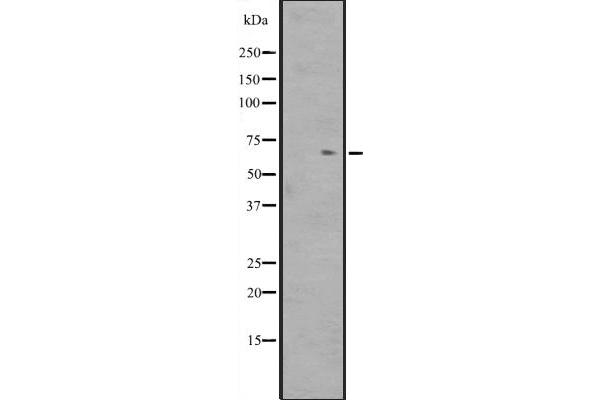 ZNF416 antibody