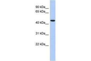 Image no. 1 for anti-Zinc Finger Protein 566 (ZNF566) (AA 143-192) antibody (ABIN6742647) (ZNF566 antibody  (AA 143-192))