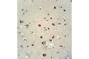 Formalin fixed, paraffin embedded human brain tissue stained with RILPL1 Antibody (C-term) followed by peroxidase conjugation of the secondary antibody and DAB staining.