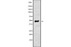 Western blot analysis of MRPS31 using HeLa whole cell lysates (MRPS31 antibody  (Internal Region))