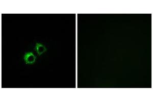 Immunofluorescence analysis of MCF-7 cells, using MRPS21 antibody. (MRPS21 antibody  (Internal Region))