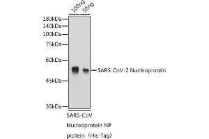 Western blot analysis of Recombinant Nucleoprotein of Coronavirus SARS-CoV-2,using SARS-CoV-2 Nucleoprotein antibody (ABIN7269053) at 1:1000 dilution. (SARS-CoV-2 Envelope antibody)