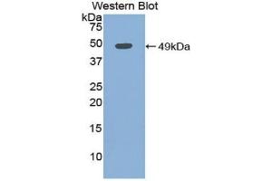 Detection of Recombinant MYO, Human using Polyclonal Antibody to Myoglobin (MYO)