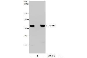 Immunoprecipitation (IP) image for anti-Heat Shock Protein 90kDa beta (Grp94), Member 1 (HSP90B1) (C-Term) antibody (ABIN2855586)