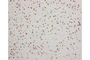 IHC-P: PDK2 antibody testing of rat brain tissue (PDK2 antibody  (C-Term))