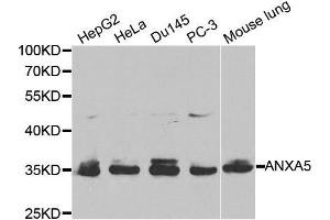 Western blot analysis of extracts of various cell lines, using ANXA5 antibody. (Annexin V antibody  (AA 1-320))