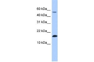 WB Suggested Anti-LYZL6 Antibody Titration: 0. (LYZL6 antibody  (N-Term))