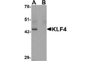 Image no. 1 for anti-Kruppel-Like Factor 4 (Gut) (KLF4) (C-Term) antibody (ABIN1449393) (KLF4 antibody  (C-Term))