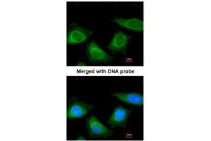 ICC/IF Image Immunofluorescence analysis of paraformaldehyde-fixed HeLa, using TBG, antibody at 1:200 dilution. (SERPINA7 antibody  (Center))