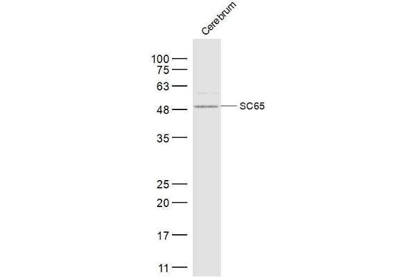 Leprecan-Like 4 antibody  (AA 1-100)