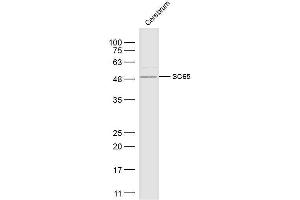 Leprecan-Like 4 antibody  (AA 1-100)