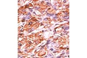 Image no. 2 for anti-Retinoblastoma 1 (RB1) (pSer811) antibody (ABIN358217) (Retinoblastoma 1 antibody  (pSer811))