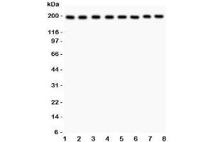 Western blot testing of ZO-1 antibody and Lane 1:  rat liver;  2: mouse liver;  3: (r) NRK;  4: (r) PC12;  5: human HeLa;  6: (h) SMMC-7721;  7: (m) HEPA;  8: (h) COLO320 lysate. (TJP1 antibody  (AA 1178-1527))