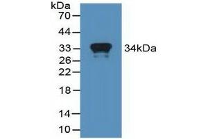 Detection of Recombinant MX1, Human using Polyclonal Antibody to Myxovirus Resistance 1 (MX1) (MX1 antibody  (AA 80-342))