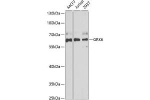 Western blot analysis of extracts of various cell lines, using GRK6 antibody (ABIN6130404, ABIN6141417, ABIN6141418 and ABIN6222000) at 1:1000 dilution. (GRK6 antibody  (AA 1-170))