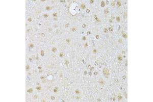 Immunohistochemistry of paraffin-embedded rat brain using HDAC3 Antibody (ABIN5971166) at dilution of 1/100 (40x lens).