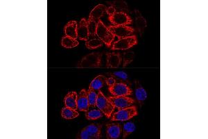 Confocal immunofluorescence analysis of HeLa cells using Cytokeratin 17 (KRT17) antibody (ABIN6130112, ABIN6143023, ABIN6143024 and ABIN6213626) at dilution of 1:200. (KRT17 antibody  (AA 133-432))