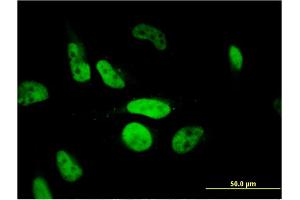 Immunofluorescence of monoclonal antibody to PHF11 on HeLa cell. (PHF11 antibody  (AA 1-292))