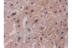 Detection of LOXL2 in Human Liver Tissue using Polyclonal Antibody to Lysyl Oxidase Like Protein 2 (LOXL2) (LOXL2 antibody  (AA 544-751))