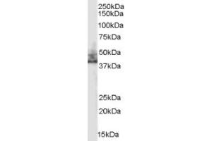 Image no. 1 for anti-Solute Carrier Family 9 (Sodium/hydrogen Exchanger), Member 3 Regulator 2 (SLC9A3R2) (Internal Region) antibody (ABIN374620) (SLC9A3R2 antibody  (Internal Region))