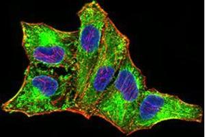 Immunofluorescence analysis of MCF-7 cells using DDX58 mouse mAb (green). (DDX58 antibody  (AA 789-925))