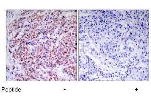 Image no. 1 for anti-Nuclear Factor-kB p65 (NFkBP65) (Thr435) antibody (ABIN197112)