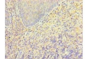 Immunohistochemistry of paraffin-embedded human tonsil tissue using ABIN7172857 at dilution of 1:100 (TRPM2 antibody  (AA 1204-1503))