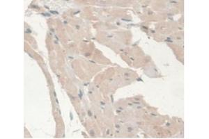 Immunohistochemistry (IHC) image for anti-Androgen Receptor (AR) (AA 491-679) antibody (ABIN7427894)